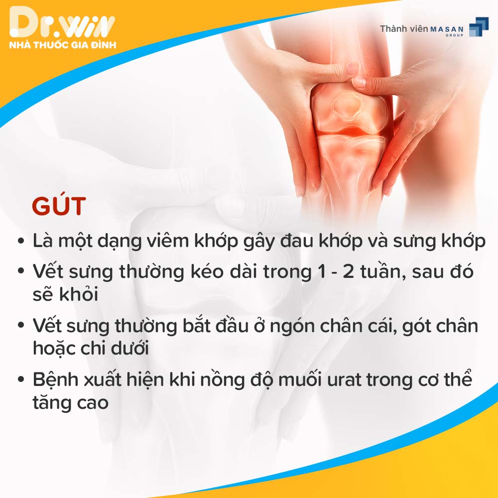 VIÊM KHỚP VÀ NHỮNG ĐIỀU CẦN BIẾT 4