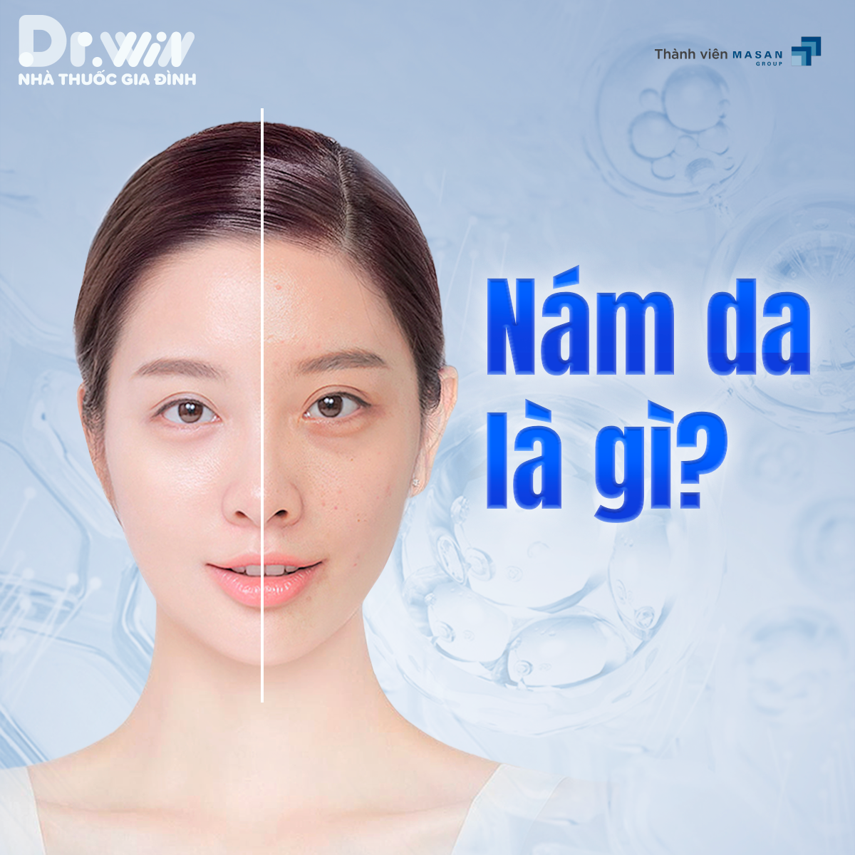 NÁM DA – HIỂU ĐỂ PHÒNG NGỪA 1